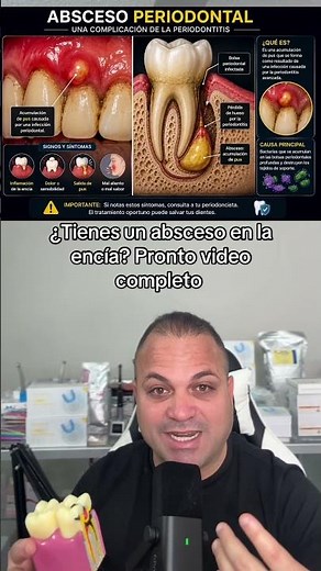 🚨 ¿Tienes un absceso en la encía? ¡No lo ignores! 🦷