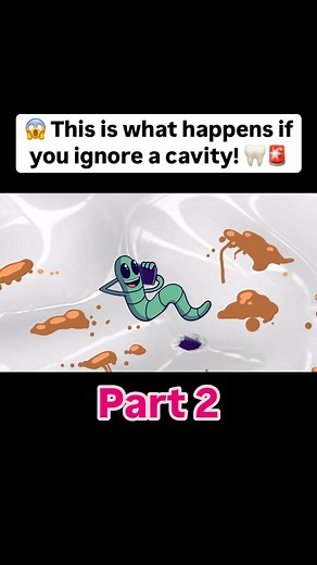 Human animation on Instagram: "醴 This is what happens next! Don’t let it get this bad!  Follow @human_animationn for Part3 and more cotent! #Dental #DentalCare #Tooth #ToothHealth #Fyp #Follow #followForMore #Part2"