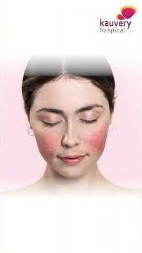 What is Systemic Lupus Erythematosus (SLE)? | Kauvery Hospital Chennai | #WorldLupusDay