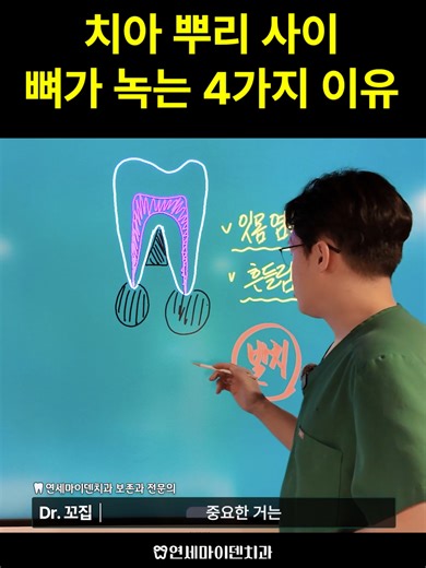 치과의사 분석: 염증과 치아 뿌리 문제