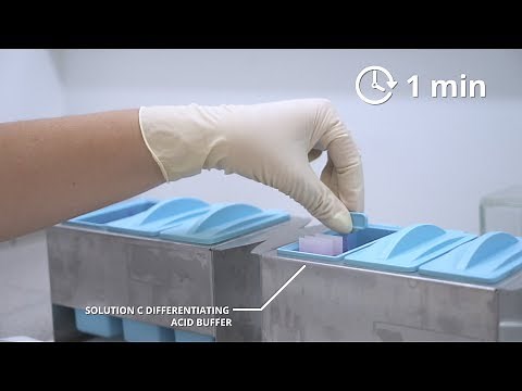 Staining with Ziehl Neelsen method