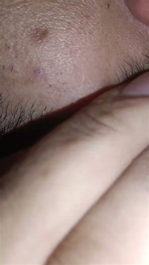 Beautiful amazing HAIR ASMR LIKE THIS #satisfying #relax #asmrsounds #growthhair #lashes #pimple