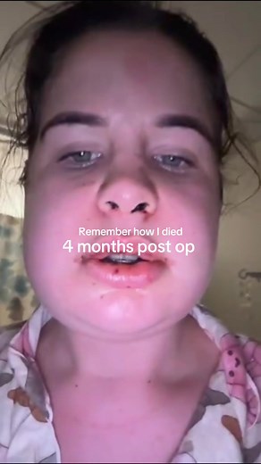 Gracie Abrams Jaw Surgery Recovery: 4 Months Post Op