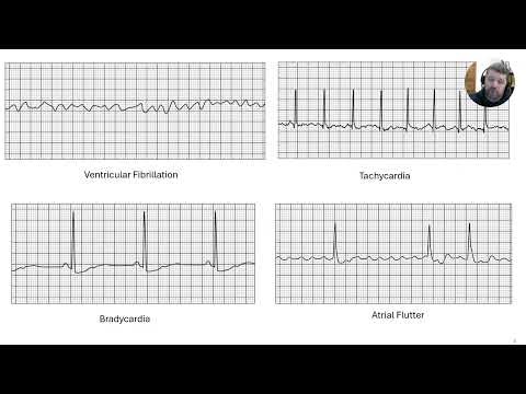 Lecture 13 Cardiovascular Part C