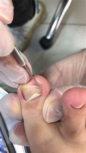 Satisfying Pedicure Video! #pedicure #toenails