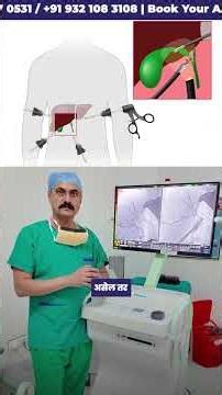 Cholangiogram in 60 Seconds | Must Know Before Surgery #drbipinvibhute