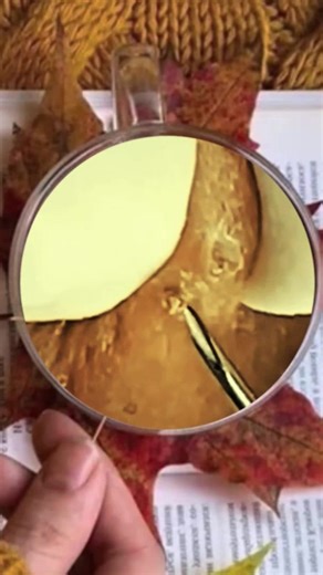 Satisfying Pimple Popping Compilation