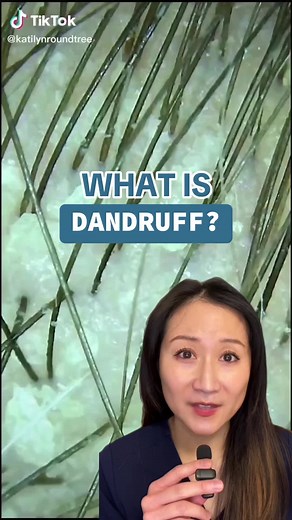 You could have fine flakes from eczema, it dandruff is due to sebum yeast overgrowth! #dermreacts #dandruffproblem #dandruffsolution #scalpcareisimportant #scalpcaretips #healthyhair #seborrheicdermatitis #dermatologist