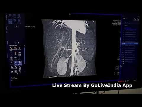 Live ct scan triple phase