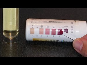 Urine Ketone Test Strips ; Definition, How they Work, Uses, Procedure, Result interpretation