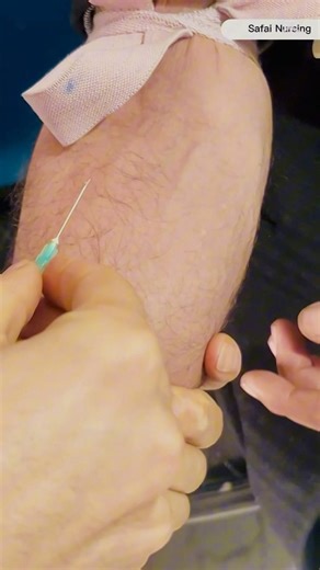 The Easiest Way to Find a Vein! 💉 IV Cannulation Technique#shortsviral #ivinsertion #hospital#nurse