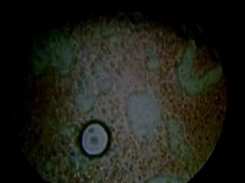 Blood Cells at 1000x Magnification (Oil Immersion)