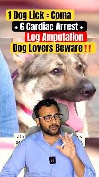 She Loved her pet & 1 Dog Lick→ Sepsis→ Cardiac Arrest→ 4 Limbs Gone in 24 hrs😱|Dog Lovers Beware‼️