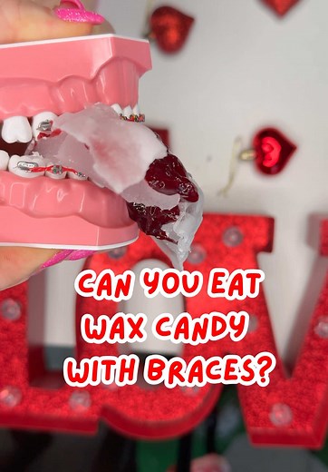 Braces Care Tips and Wax Uses for Comfort