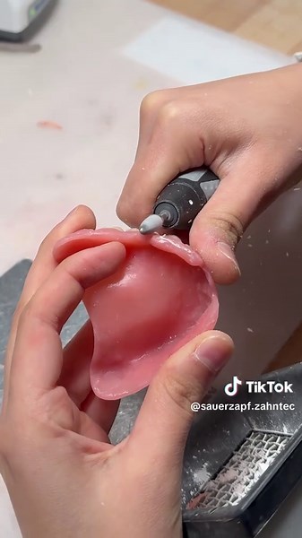 Vollprothese: Schritt-für-Schritt im Dentallabor