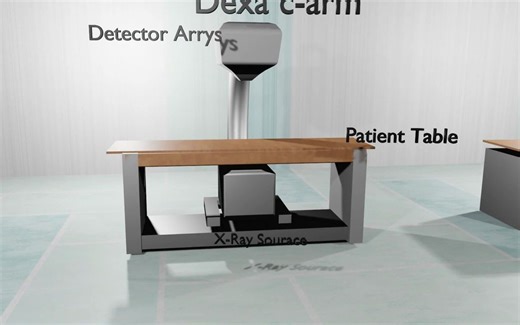 X线设备介绍 第三部分 骨密度检查