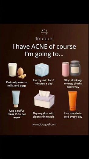 Teen Acne Cure: Try This Routine for Clear Skin! ✨👌 #acne#acnetips #clearskin