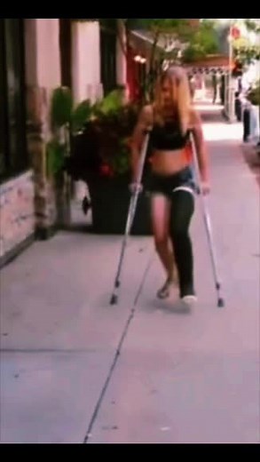 Lovely Shannon Enjoys Life in a Full Leg Cast
