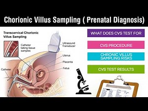 Chorionic villus sampling | prenatal diagnosis | placental tissue | chorionic villi test in Hindi