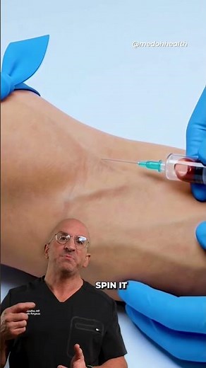 Can PRP Injections Really Help Knee Arthritis? What New Research Shows