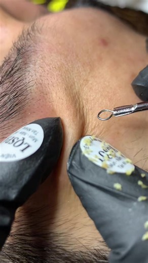 Hướng Dẫn Quy Trình Skincare Đúng Cách