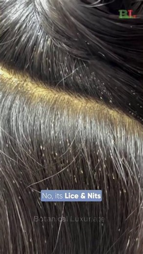 She was struggling with lice and stubborn nits