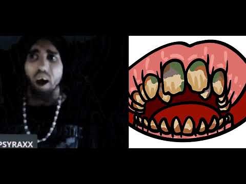 Cyraxx Case Study: His Teeth