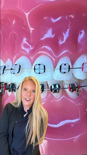 3 Spooky Braces Colors for Halloween 🎃 #braces #orthodontics