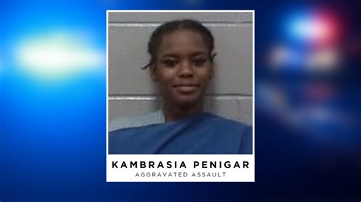 Woman accused of biting off another woman’s thumb during altercation