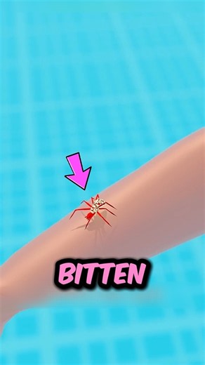 What To Do If a Spider Bites You! 🕷️😱