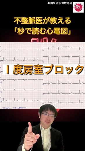 【不整脈医が教える「秒で読む心電図」】