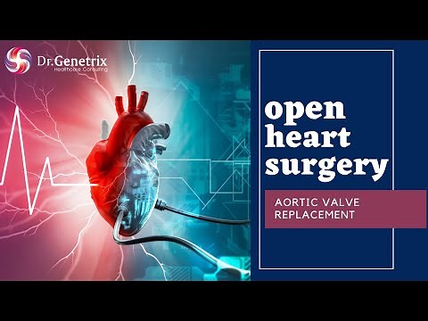 Aortic Valve Replacement Surgery | Open Heart Surgery ❤️