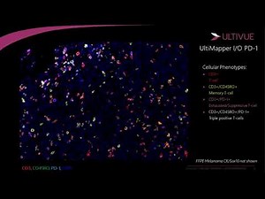 Visualize more biomarkers and extract more insights: Moving from single marker IHC to multiplex IF