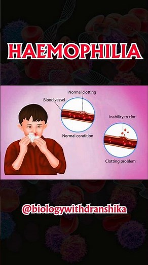 Haemophilia – a rare genetic disorder where blood doesn’t clot properly. #haemophilia #bloodsafety