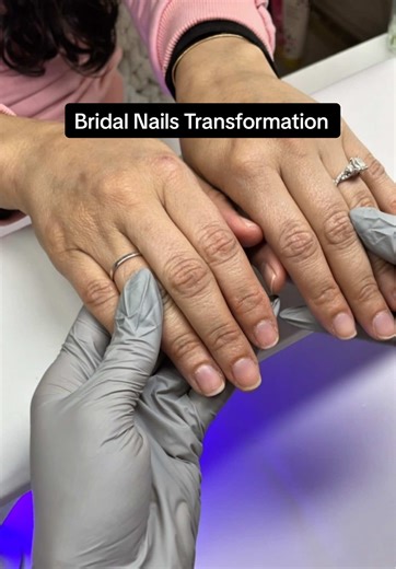 Bridal Nails Transformation: Elegance and Skin Health