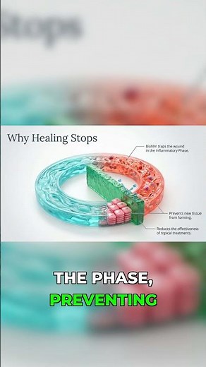 How Biofilm STOPS Wound Healing: The Science