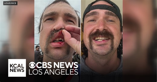 Huntington Beach dentist helps Marine Corps veteran who brook tooth during surfing event