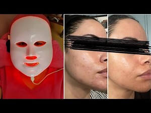Before and After: The Real Effects of Red Light Therapy on Skin