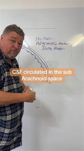 91K views · 2.1K reactions | Do you know your intra cranial bleeding types? in this video I do a very quick out of you.##fyp##paramedicsoftiktok##nursesoftiktok##ECT4Health##nurseeducation##paramediceducation##tbi##headtrauma##intracranialpressure | ECT4Health- Nurse/Paramedic Education | Facebook