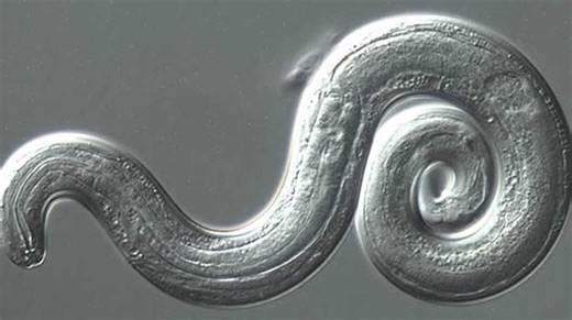 Brain parasite found in Georgia, what you need to look out for