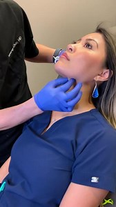 Kybella Jowls & double chin treatment