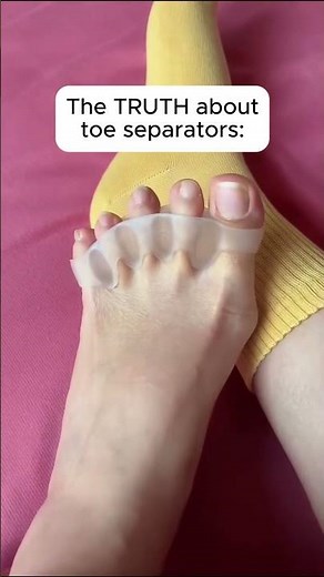 The TRUTH about toe separators #doctor #painrelief