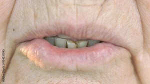 Mouth of old woman aged 80s with false teeth. Close up
