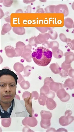 Meet the eosinophil: Atlas of hematology