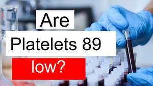 Is Platelet count 89 low, normal or dangerous? What does Platelet count level 89 mean?