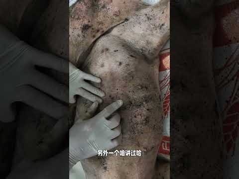 Dead Pig Post-Mortem: The Ultimate Guide to Swine Disease Prevention