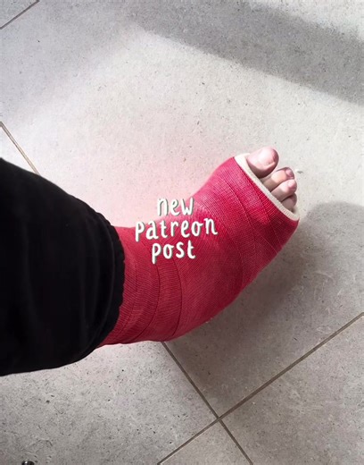 Broken leg ankle foot gips yeso gesso platre casted up medical fracture wheelchair fauteuil roulant os cassé pied cassé jambe cheville plaster plastercast orteils toes chaussette sock white kryckor gipsz runc gamba #cast #brokenleg #platre #medical #brokenankle rouge red