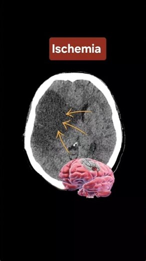 CT SCAN #anatomy #ctscan #doctor #medicalimaging #ctscans #science #medicaltest #biology #bones