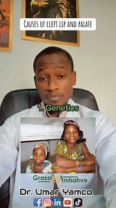 1.1K views · 76 reactions | Causes of cleft lip and palate.. #awareness #wellness #healthtips #hausafulani | Umar Yahaya Ahmad | Facebook