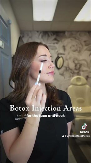 FDA-approved Botox Injection areas for the face and neck